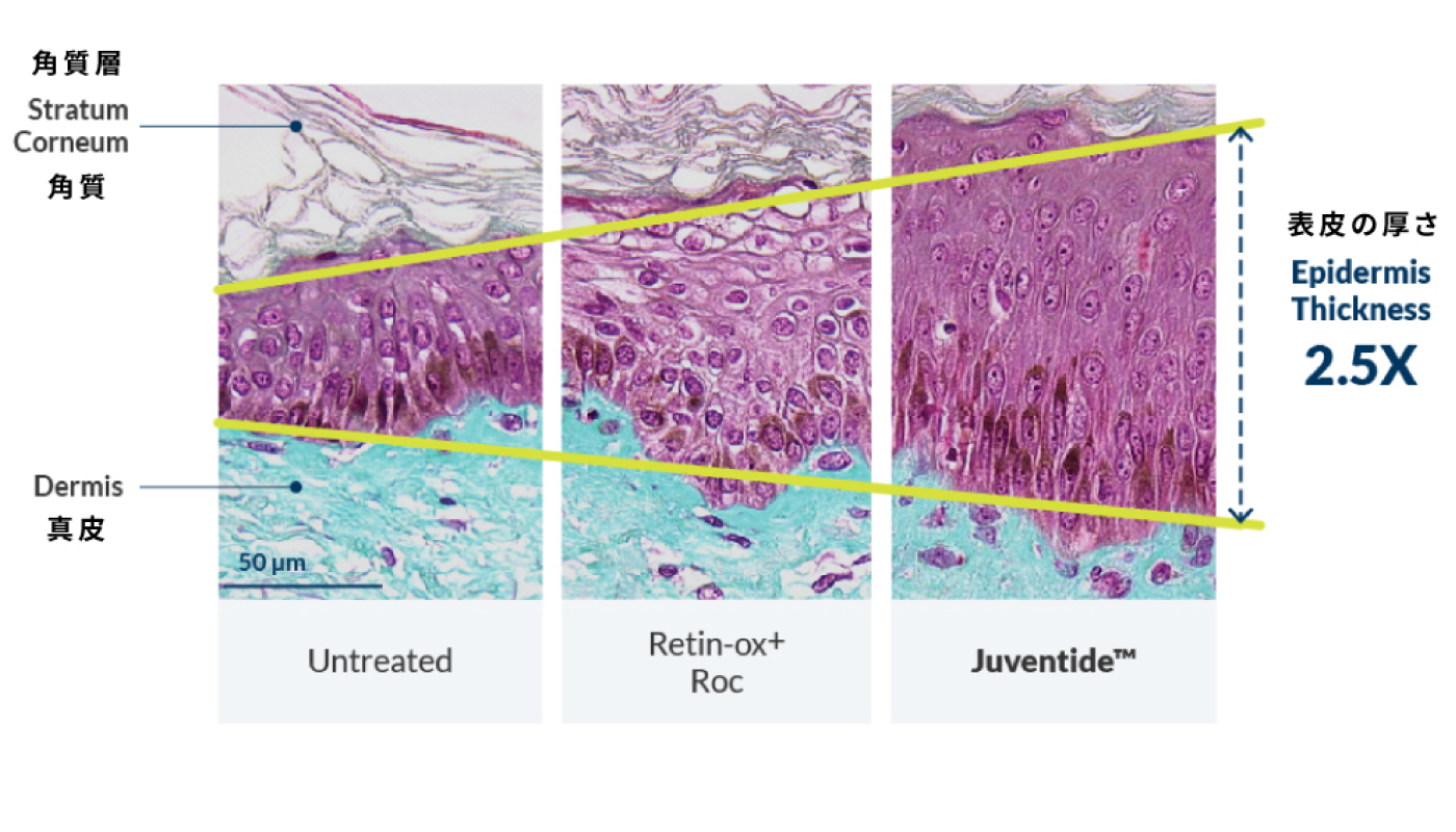 Juventide™とレチノール配合の他社クリームの比較。