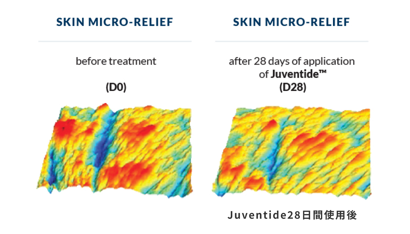 Juventide™1.6％配合クリームを、一日に2回、28日間顔に塗布。